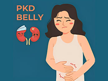 Was ist PKD-Bauch?